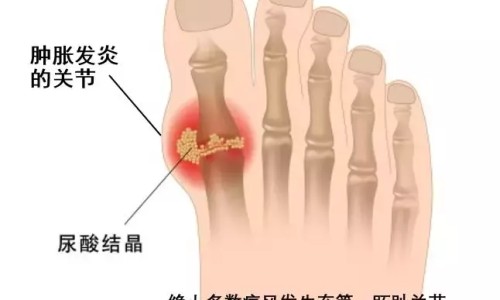 美素佳儿荷兰版可靠吗-荷兰本土美素与美素佳儿的区别网- 荷兰本土美素佳儿奶粉怎么样知识,分享美素佳儿国内和荷兰区别